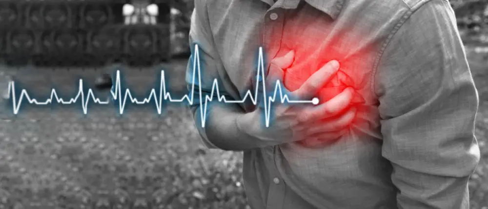 Understanding Heart Palpitations: Causes, Diagnosis & Treatment ...